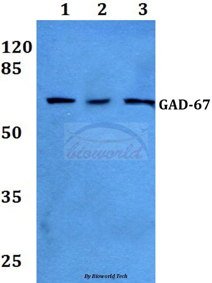 AntiGAD67 (A492) Antibody (A25164)